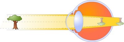 astigmatism.jpg