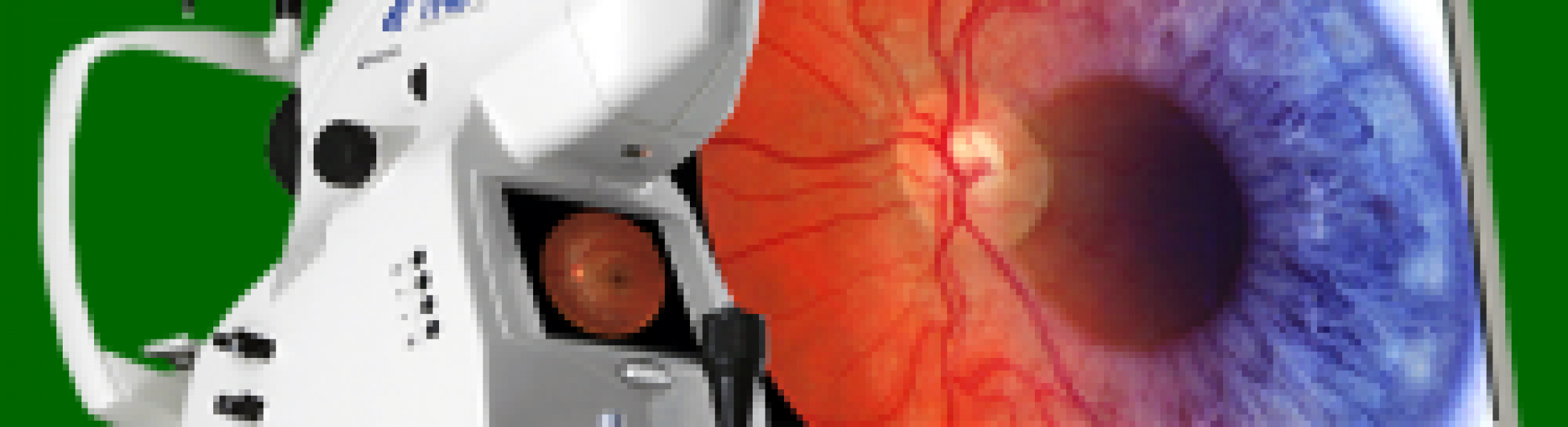 Fundus Photography – Hammond Optical